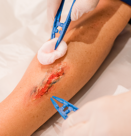 Wound Care